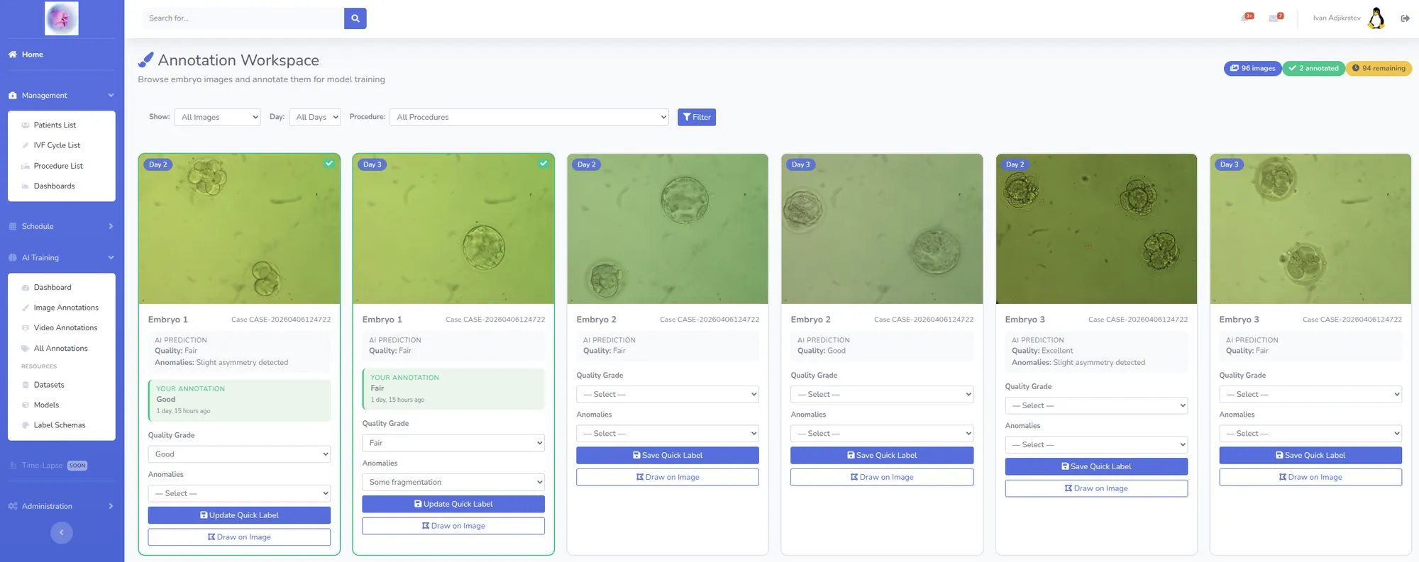 Annotation embyons