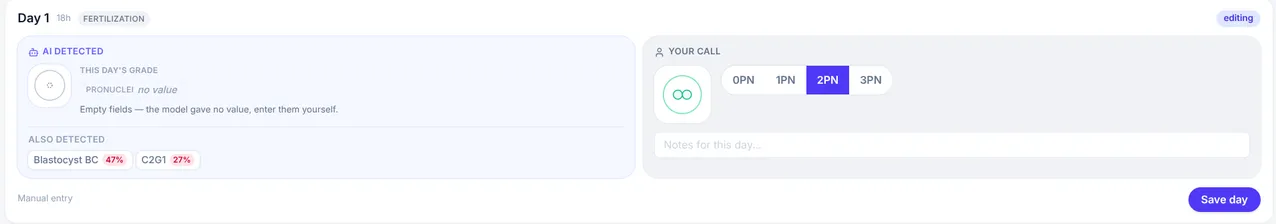 One day of embryo review in EMBRY. An AI detected panel reports this day's grade, marks pronuclei as no value with the note that empty fields must be entered by hand, and lists other detections with confidence. Beside it, a Your call panel lets the embryologist select 0PN, 1PN, 2PN or 3PN and add notes.