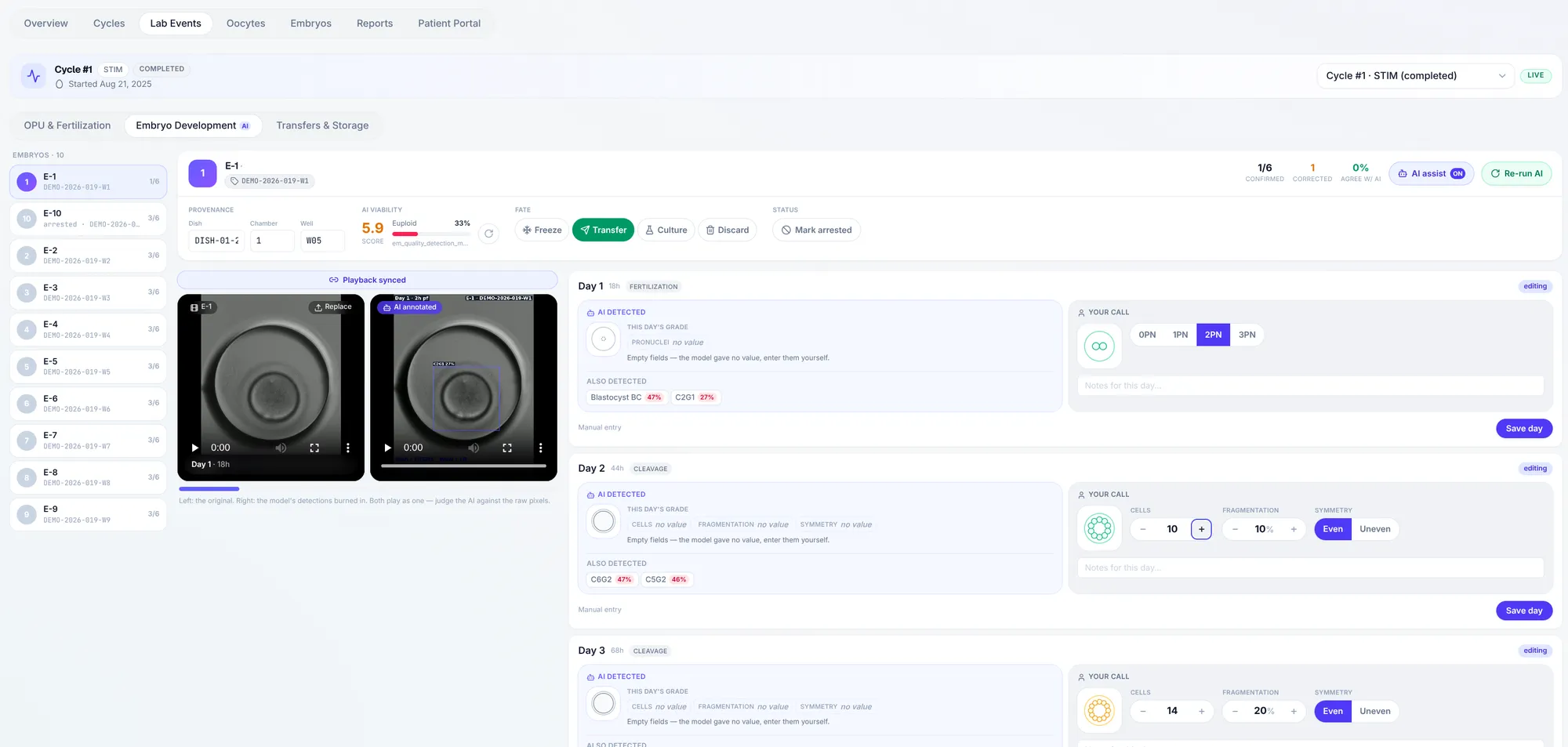 EMBRY embryo development screen: for each day, an AI detected panel on the left shows the model's grade and what it left blank, next to a Your call panel where the embryologist records pronuclei, cell count, fragmentation and symmetry.